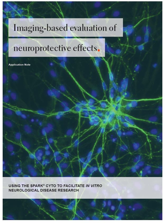 アプリケーションノート：Neurophysiology (神経毒性とメカニズム解析)